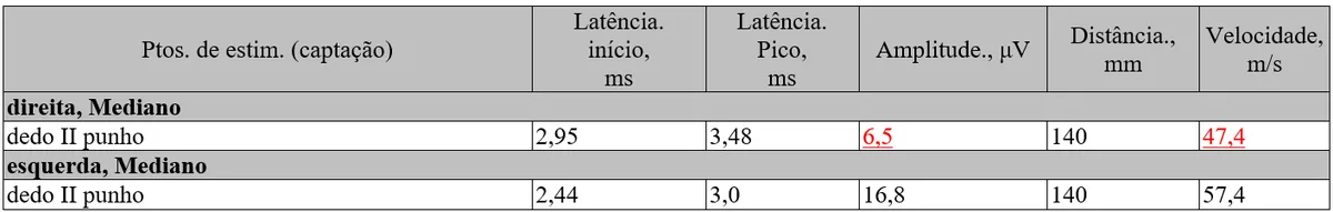 Tabela com latência, amplitude, distância e velocidade do nervo mediano direito e esquerdo na eletroneuromiografia, destacando velocidade de 47,4 m/s e amplitude de 6,5 µV no lado direito.